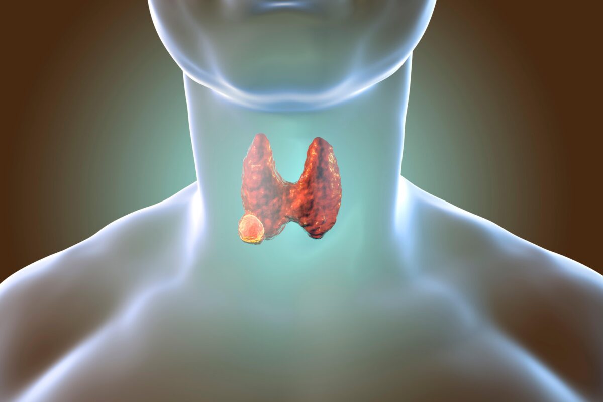 thyroid-cancer-3d-illustration-showing-thyroid-gland-with-tumor-inside-human-body-1200x800.jpg